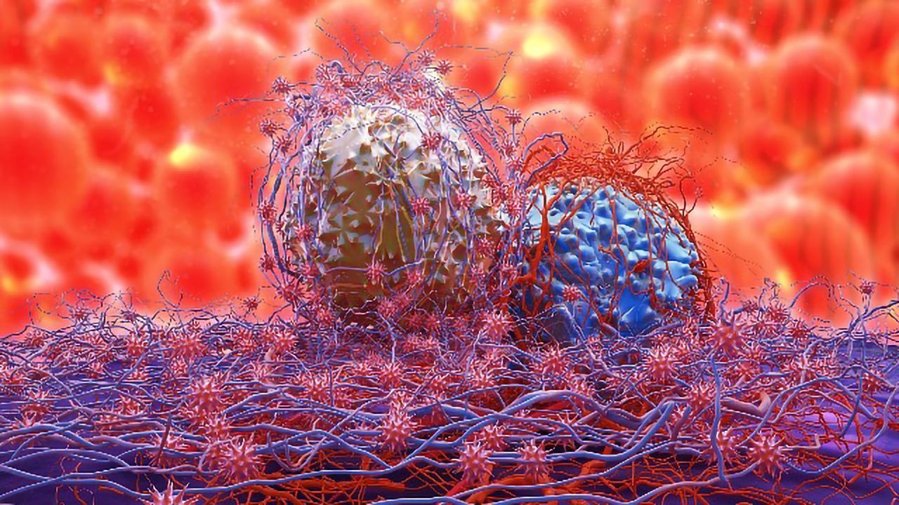 Nanoparticles Deliver Bursts of Calcium To Destroy Drug-Resistant Tumor Cells
