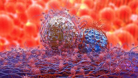 Nanoparticles Deliver Bursts of Calcium To Destroy Drug-Resistant Tumor Cells