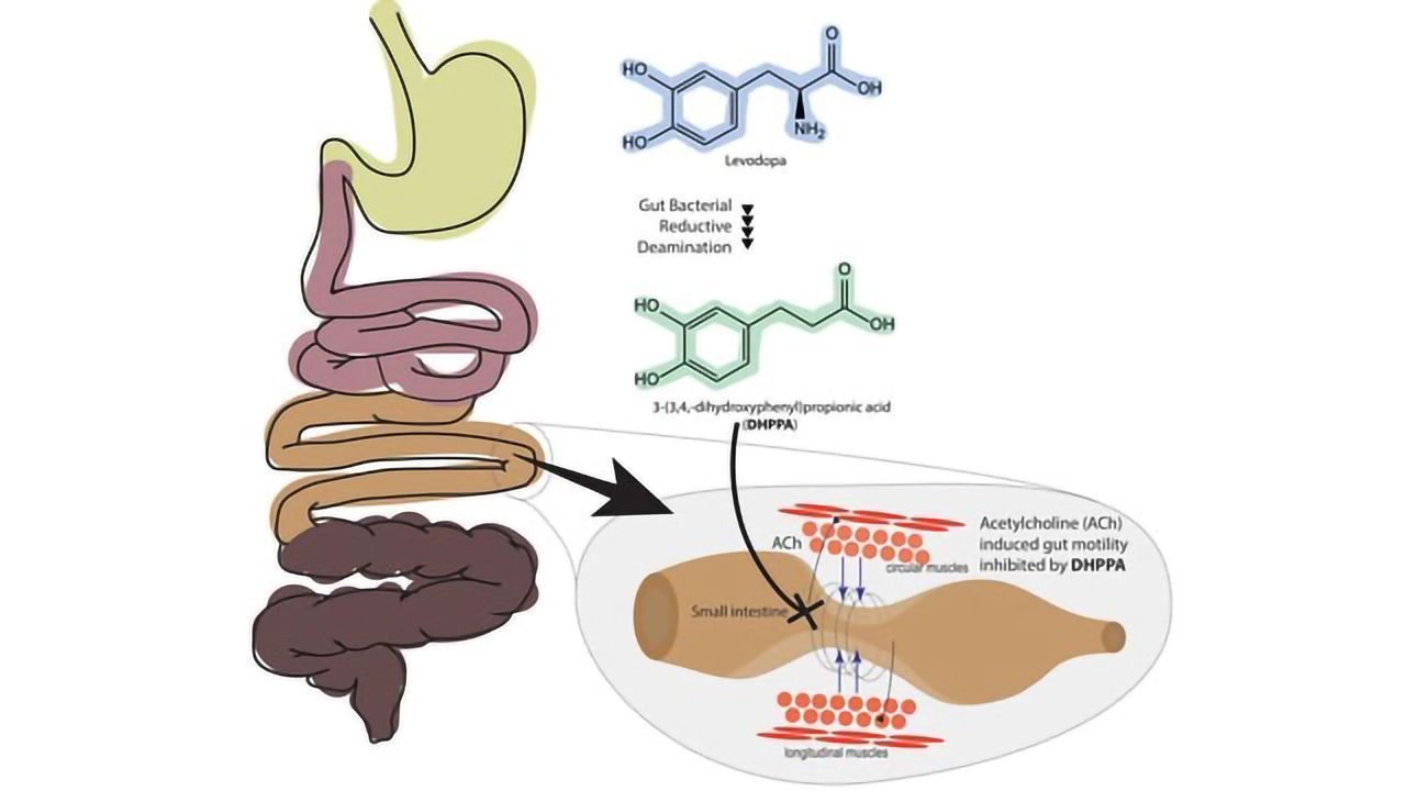 Gut Bacteria May Be Responsible for Adverse Effect of Parkinson's Drug