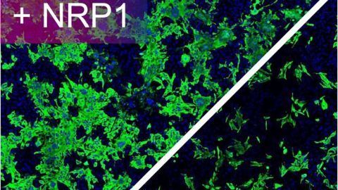 Breakthrough Shows Neuropilin-1 Drives SARS-CoV-2 Infectivity