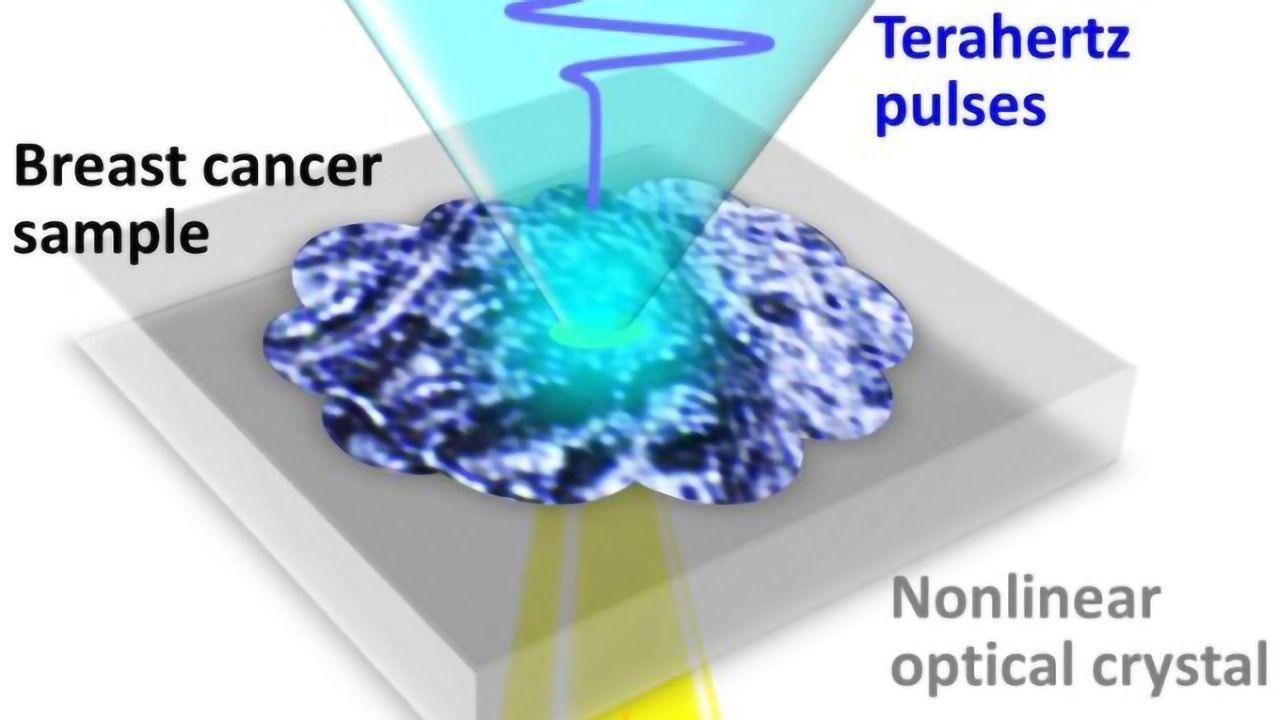 Terahertz Waves Can Image Early-Stage Breast Cancer Without Staining
