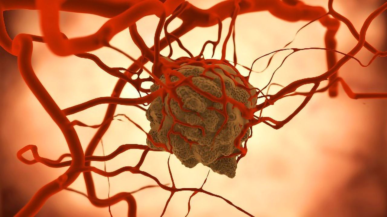 Biomarker That Appears Before Stomach Cancer Develops May Aid Early Detection