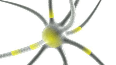Anti-Inflammatory Drug Reduces Disease Progression in Preclinical Model of MS
