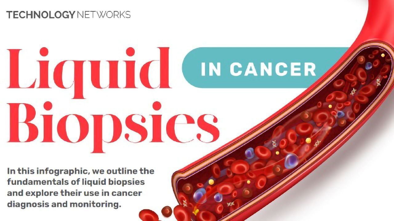 Liquid Biopsies in Cancer