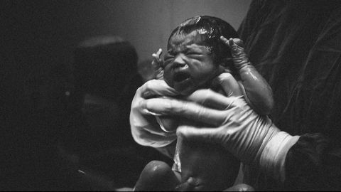 Evidence for a DNA Methylation Signature of ASD in Cord Blood