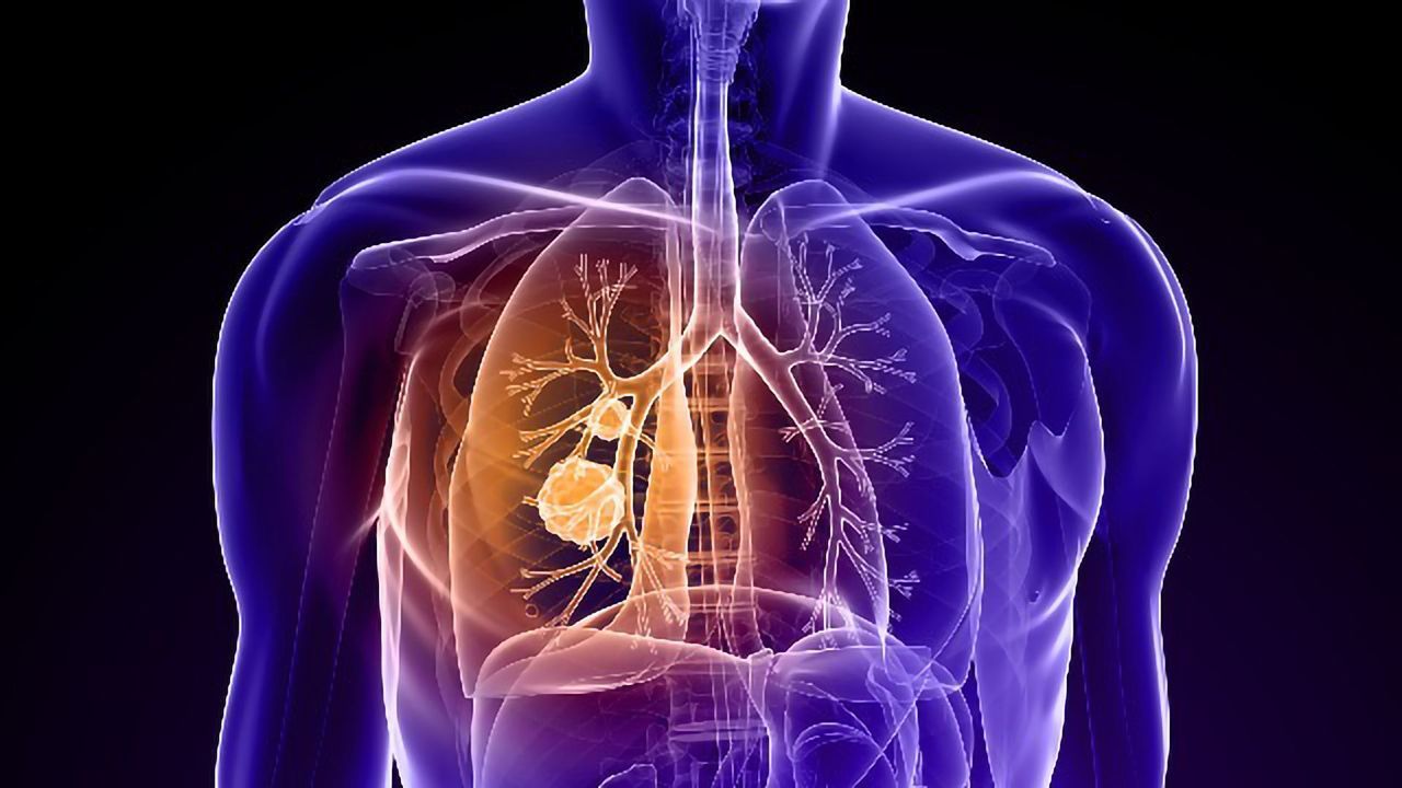 Inhibitor of Cancer-Causing <i>KRAS</i> Gene Mutation Shrinks Tumors and is Well-Tolerated