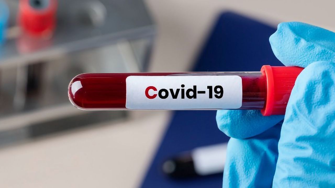Prevalence of Coronavirus Antibodies Declining in England