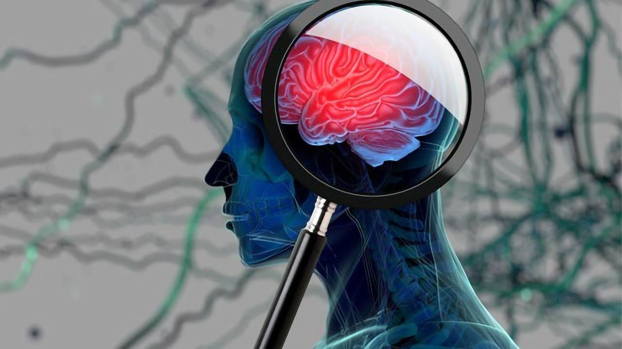 New Tactic To Stop the Growth of Glioblastoma