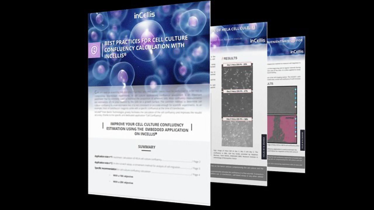 Best Practices for Cell Culture Confluency Calculation with Incellis