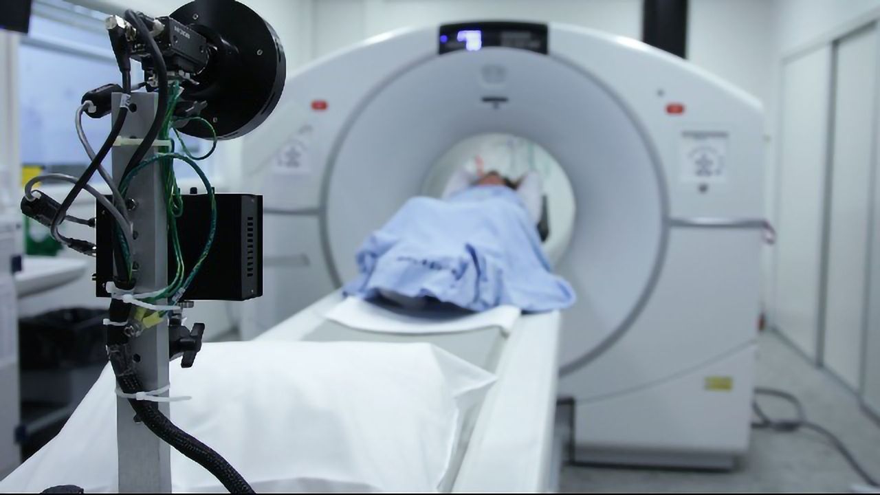 'White Matter Lesion' Mapping Tool Identifies Early Signs of Dementia