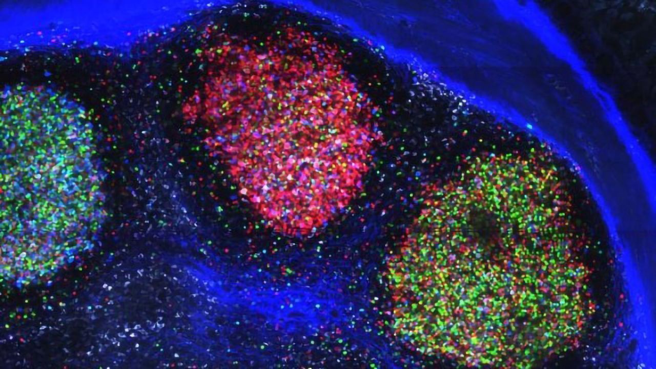 How the Immune System Tackles the Bacteria in Our Gut