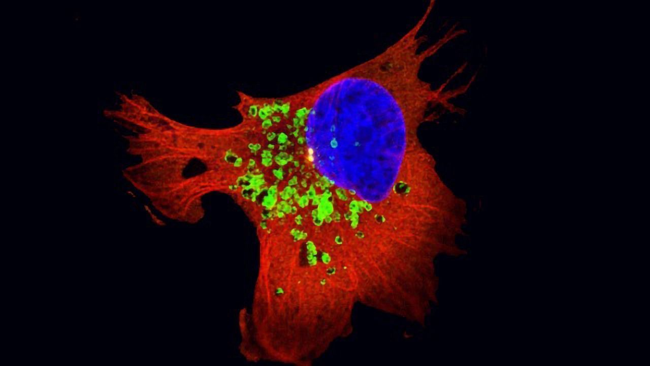Alterations in Subcellular Traffic Increases Invasiveness of Radioresistant Cancer Cells