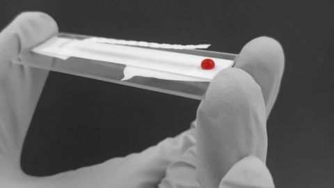 Radical Diagnostic Could Help To Save Millions of People at Risk of Dying From Blood Loss