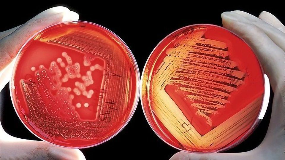 Quick Method Devised For Determining Antibiotic Resistance of Bacteria content piece image