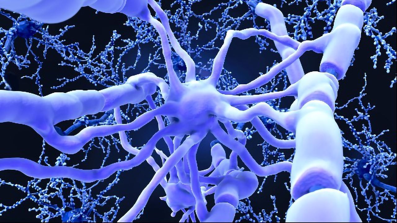 New Alzheimer's Approach Helps the Body To Fight Amyloid
