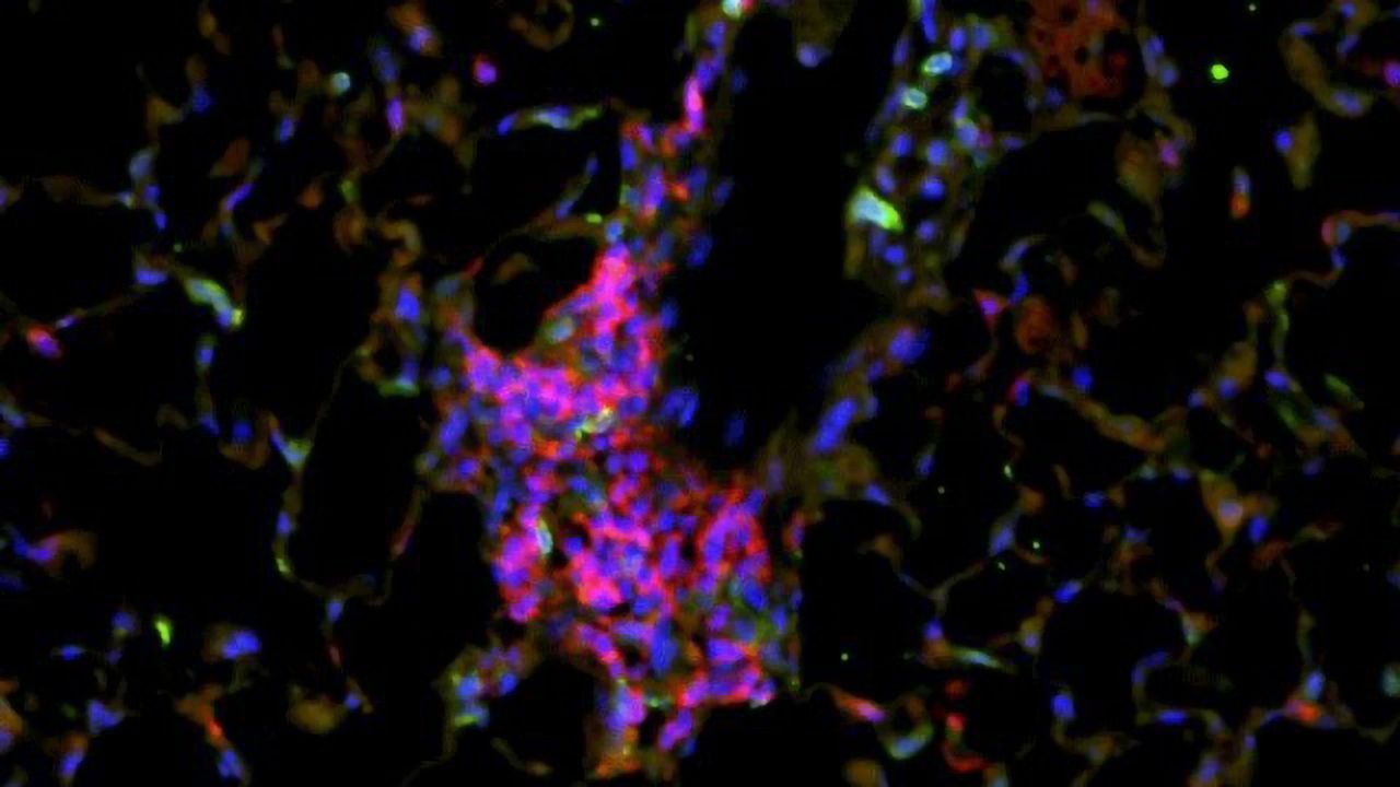 Therapeutic Approach Against COPD Shows Promise in Mouse Model