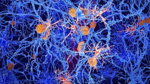 Novel Immunotherapy Proves Effective in Treating Animal Models of MS