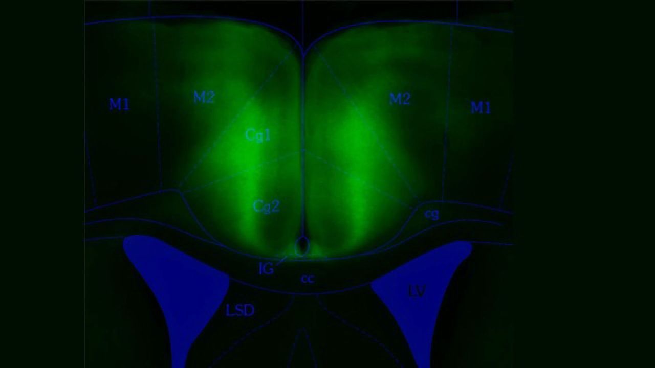 This Brain Region Predicts the Consequences of Our Actions