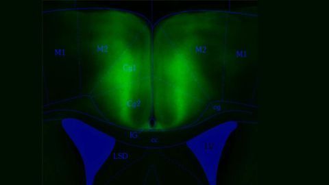 This Brain Region Predicts the Consequences of Our Actions
