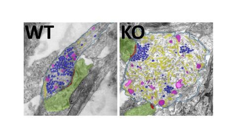 Autophagy Protects Neurons – But Not in the Way We Thought