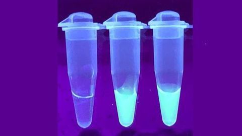 New Test Kit Could Enable Quick and Effective SARS-CoV-2 Detection