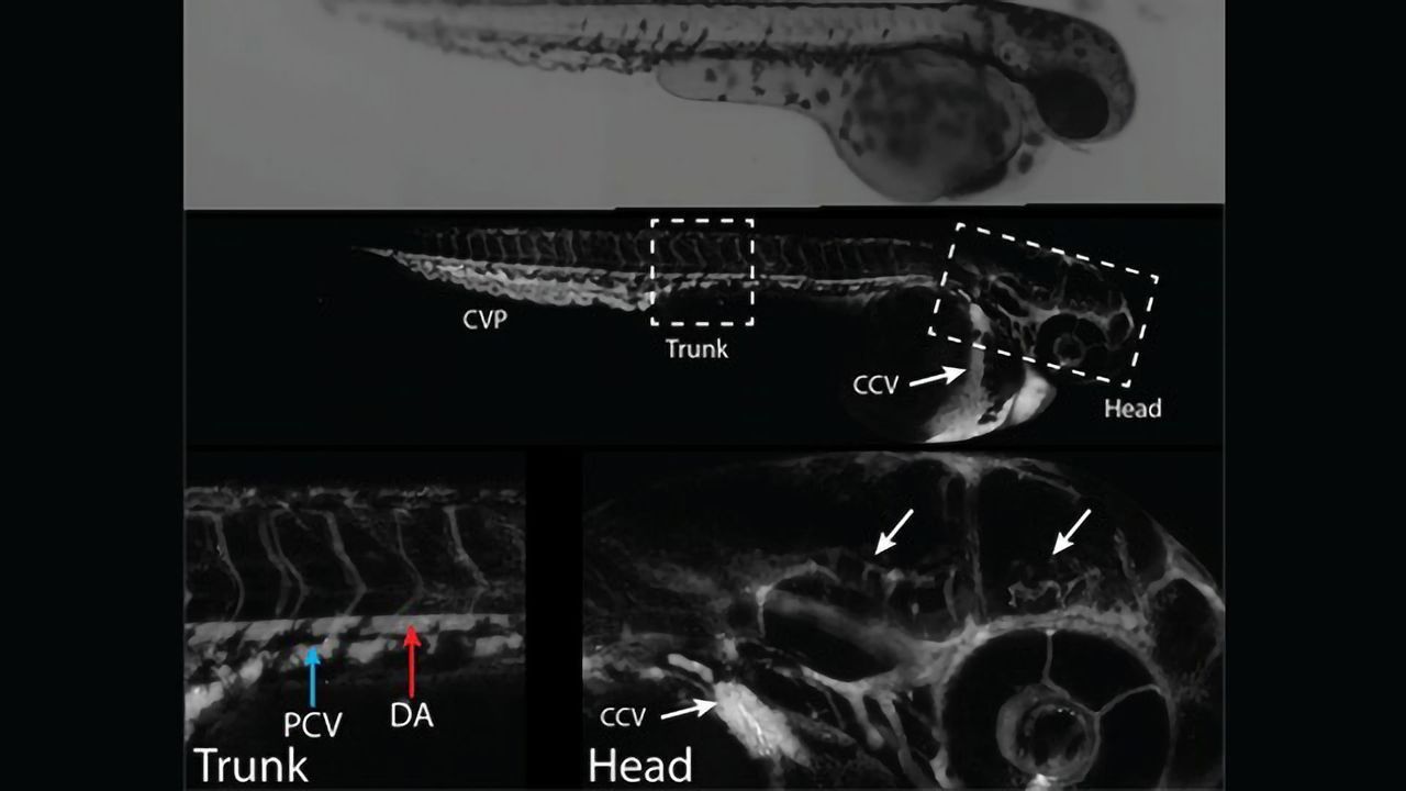 Nanoparticle-Based Delivery of Drugs to the Brain To Treat Neurodegenerative Diseases