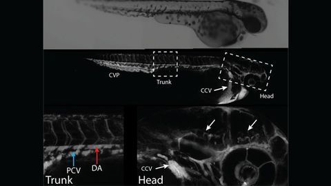 Nanoparticle-Based Delivery of Drugs to the Brain To Treat Neurodegenerative Diseases