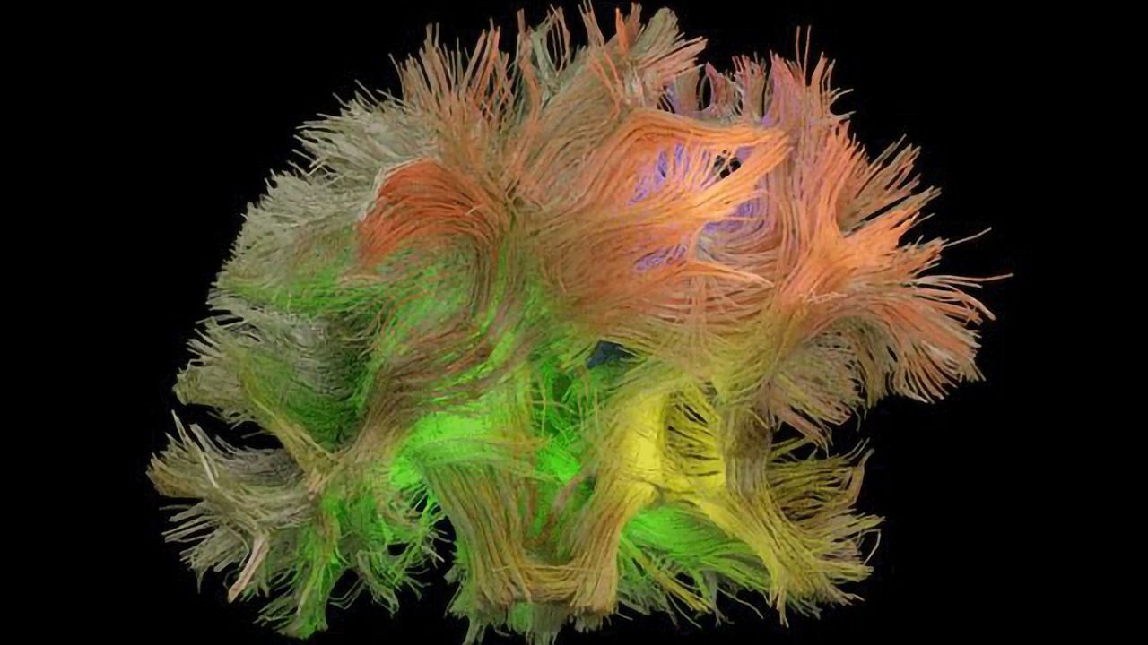 Algorithm Links Brain Signals to Specific Behaviours
