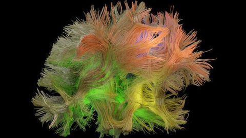 Algorithm Links Brain Signals to Specific Behaviours