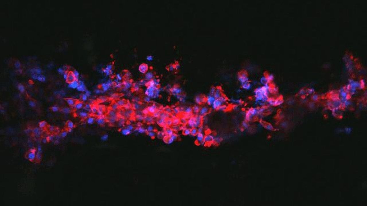 Neuron-Growing Ink Offers Hope for Nerve Repair