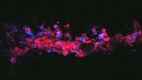 Neuron-Growing Ink Offers Hope for Nerve Repair