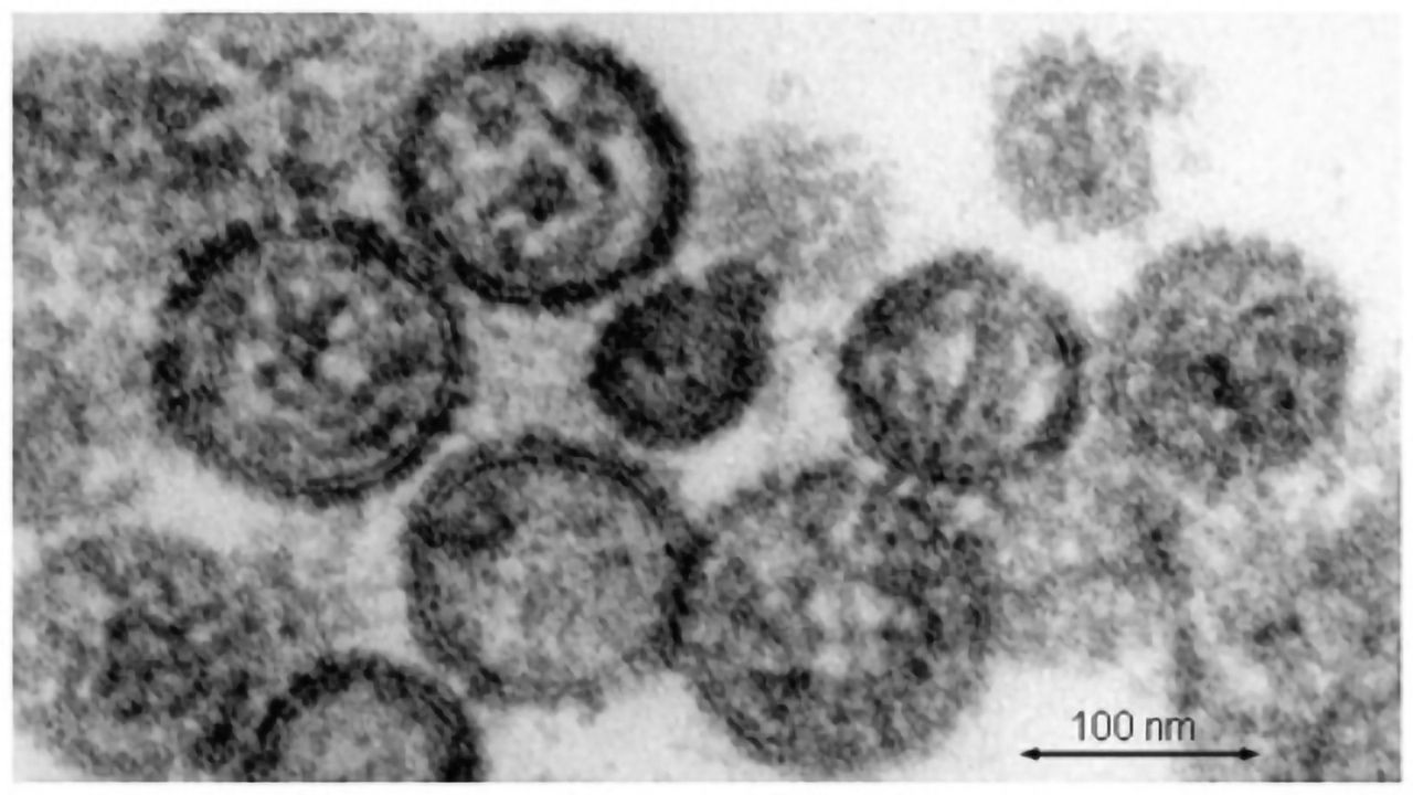 First Animal-to-Human Transmission of Deadly Hantavirus Identified in Germany