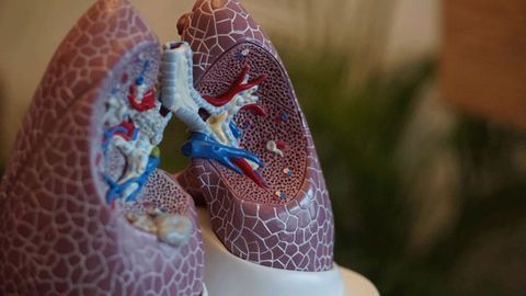 Two Targeted Therapies Developed for Idiopathic Pulmonary Fibrosis