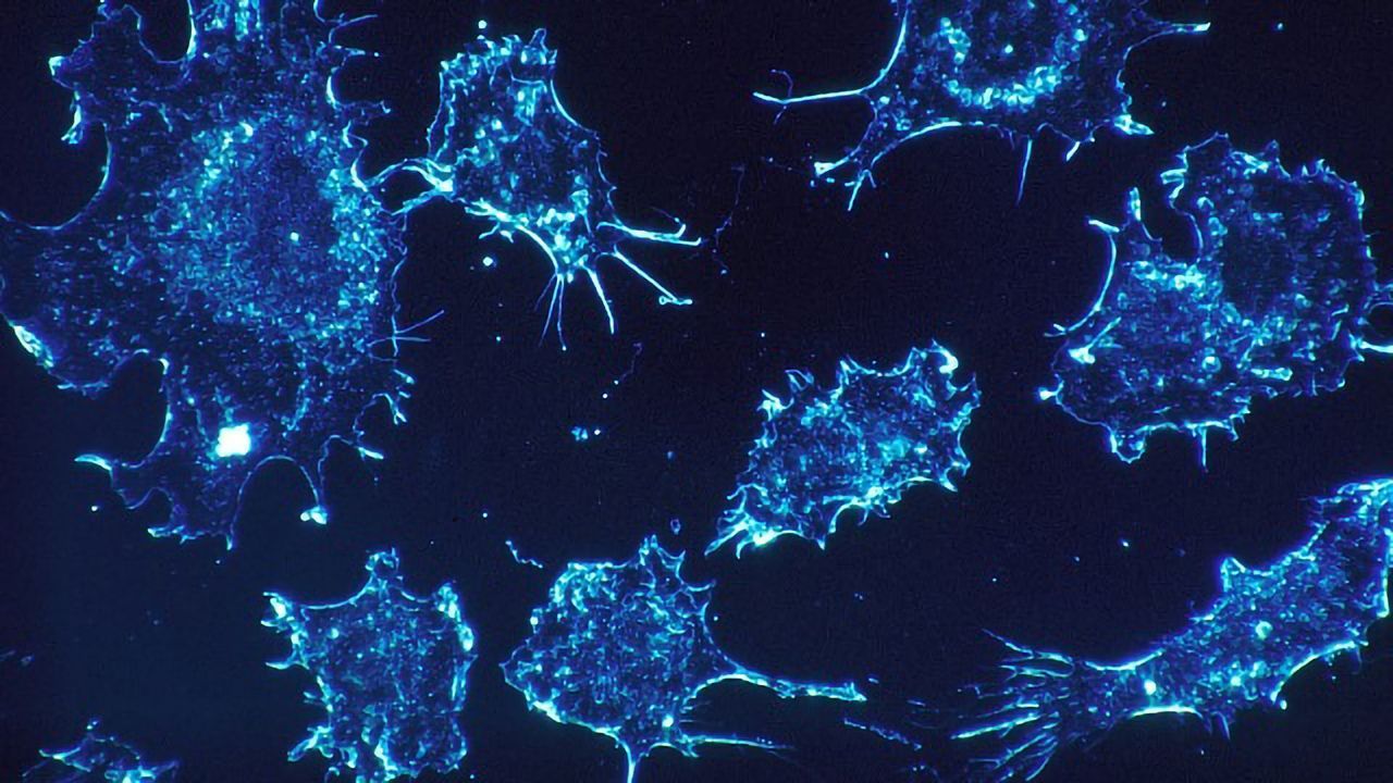 New Diagnostic Method Helps To Predict Which Cancer Patients Will Respond to Immunotherapy