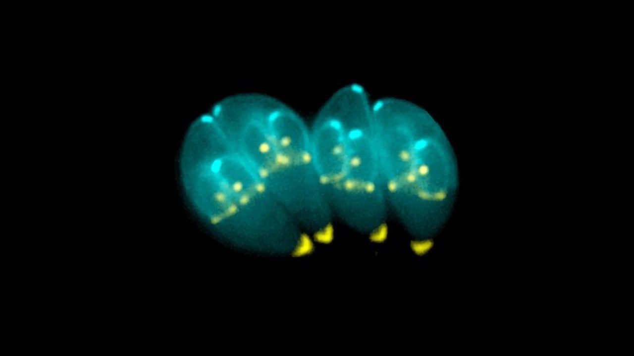 Parasite Discovery Could Have Implications for Schizophrenia Treatment