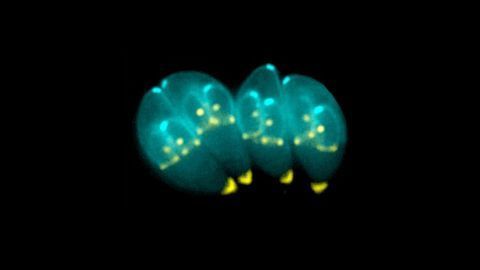Parasite Discovery Could Have Implications for Schizophrenia Treatment