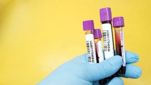 Blood Test Picks Out Cancers Likely To Benefit From Targeted Drugs