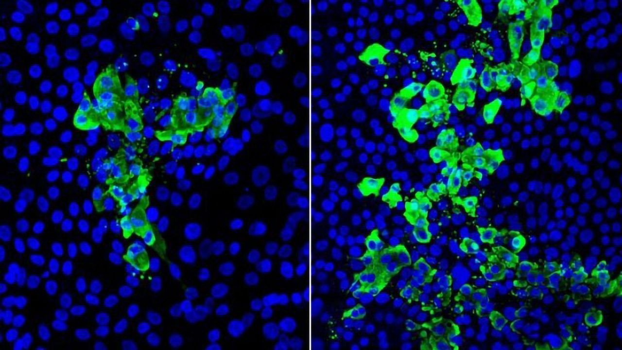 Study Reveals How Smoking Worsens COVID-19 Infection in the Airways