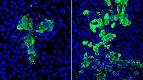Study Reveals How Smoking Worsens COVID-19 Infection in the Airways