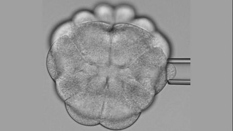 Scientists Discover How Tissue Tension Controls Cell Division