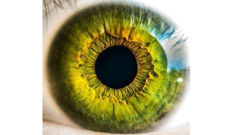 Could the Retina Hold Clues to Early Alzheimer's Diagnosis?