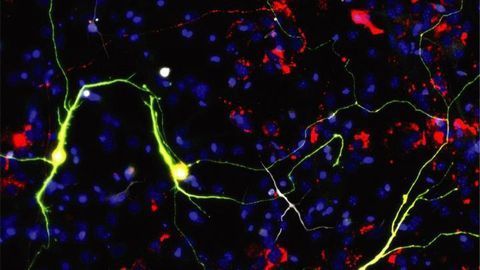 Manipulated Mitochondria Makes Reprogramming Neurons Easier