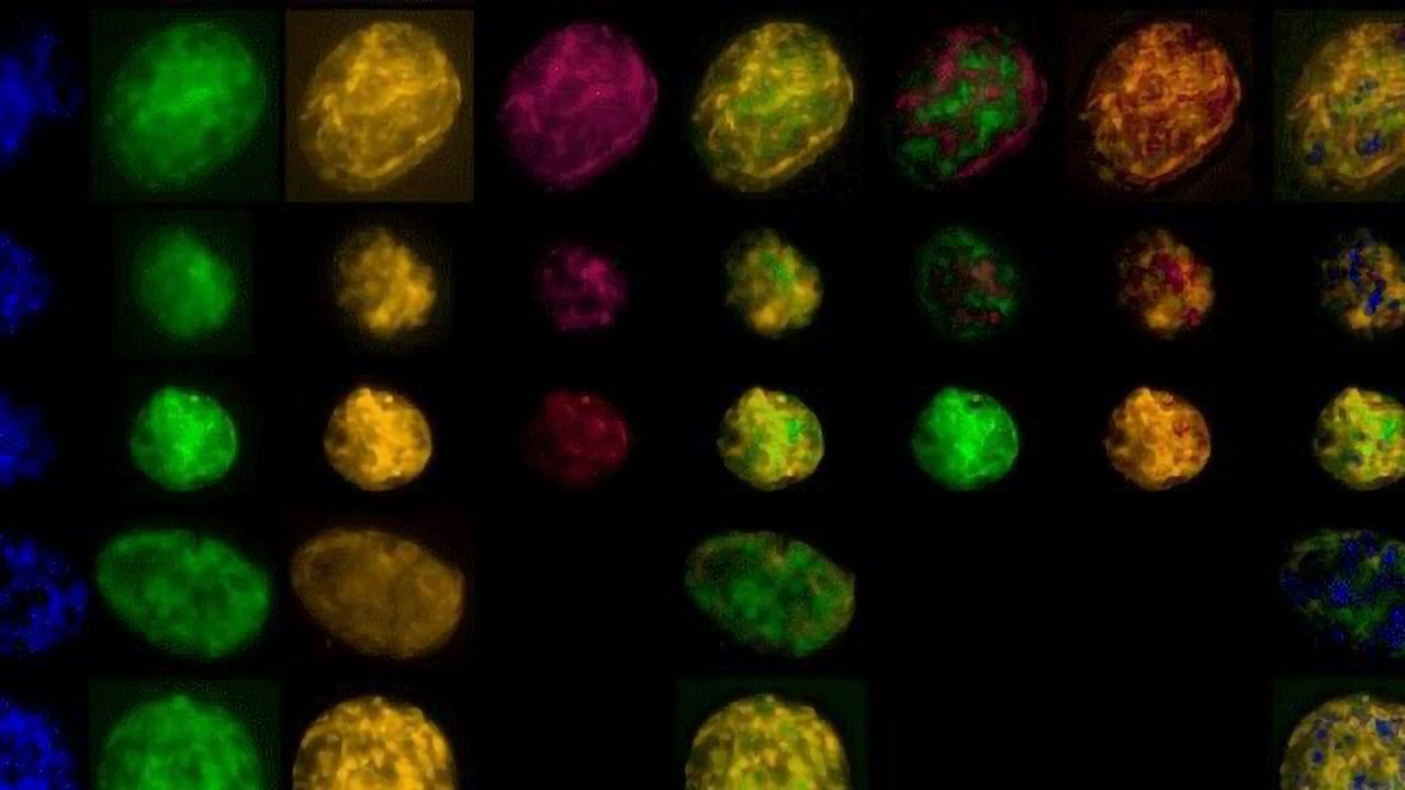 Giant Bacterium Is a Master of Adaptability