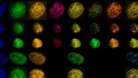 Giant Bacterium Is a Master of Adaptability