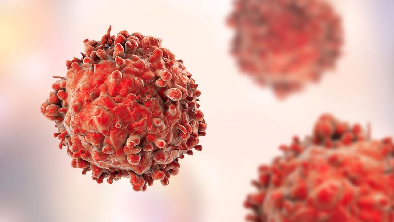 How a Brain Protein Helps Pancreatic Cancer Cells Survive