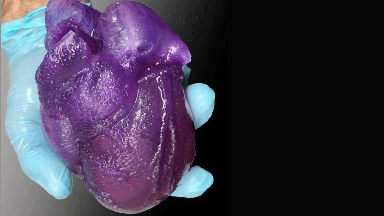 3D Bioprinted Heart Provides New Tool for Surgeons