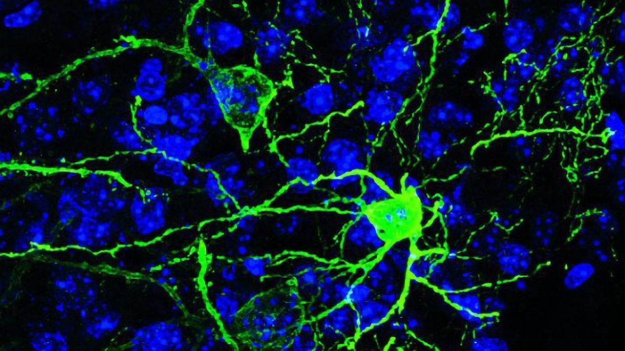 Identified: The Brain Cells That Control The Body's Response to Fear