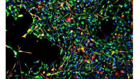Drug Directs Stem Cells to Damaged Tissue To Improve Treatment Efficacy