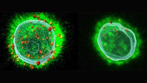 Why Immunotherapy Only Works for Some Patients With Head and Neck Cancer