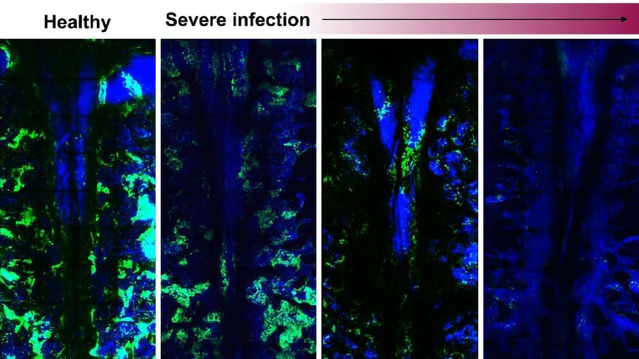 Severe Infections Wreak Havoc on Mouse Blood Cell Production